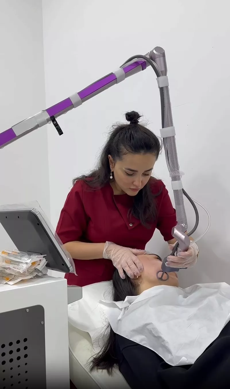 Kimyəvi Pilinq Sızanaqda Effektlidirmi?